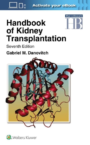 Buchcover und Innenansicht für das Buch: Handbook of Kidney Transplantation